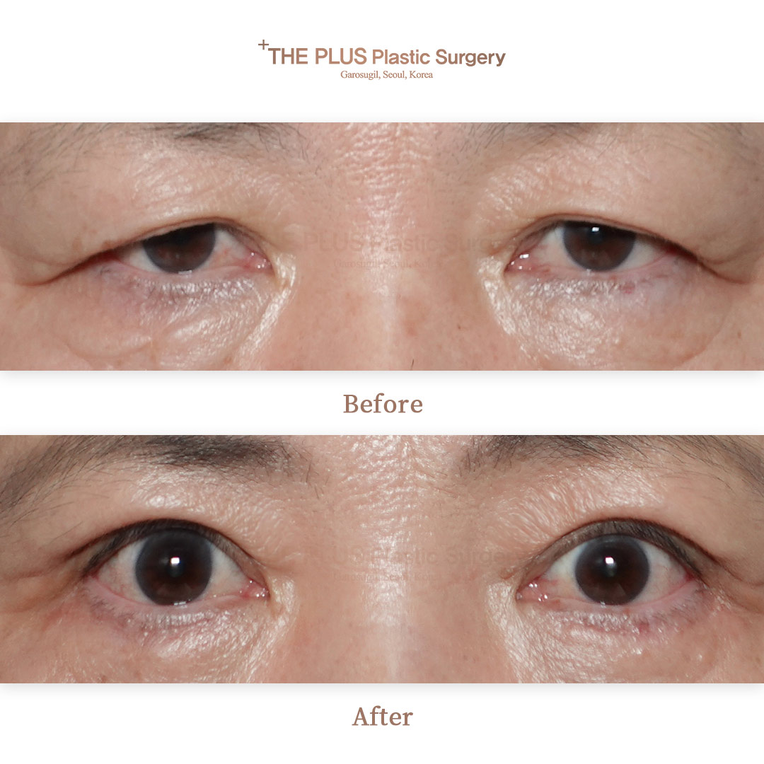 THE PLUS CLINIC KOREA -