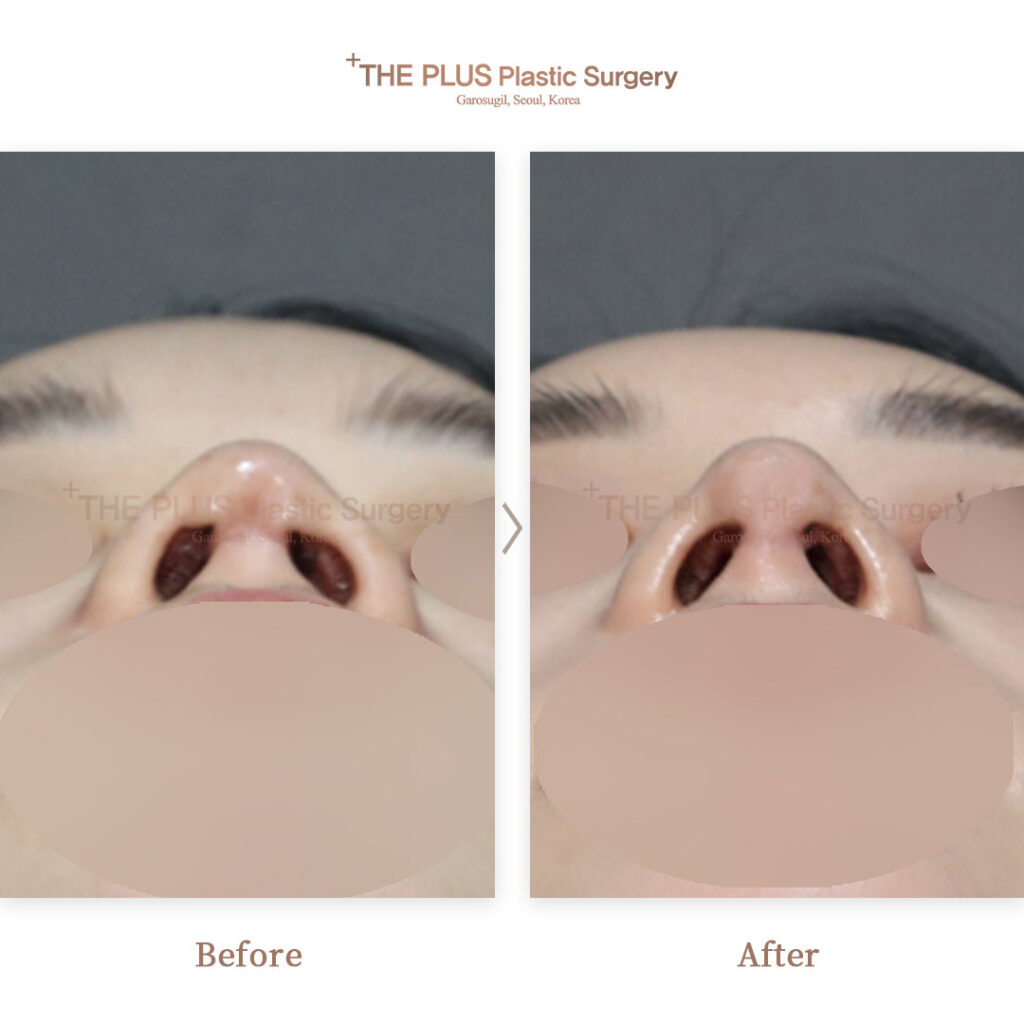 THE PLUS CLINIC KOREA -