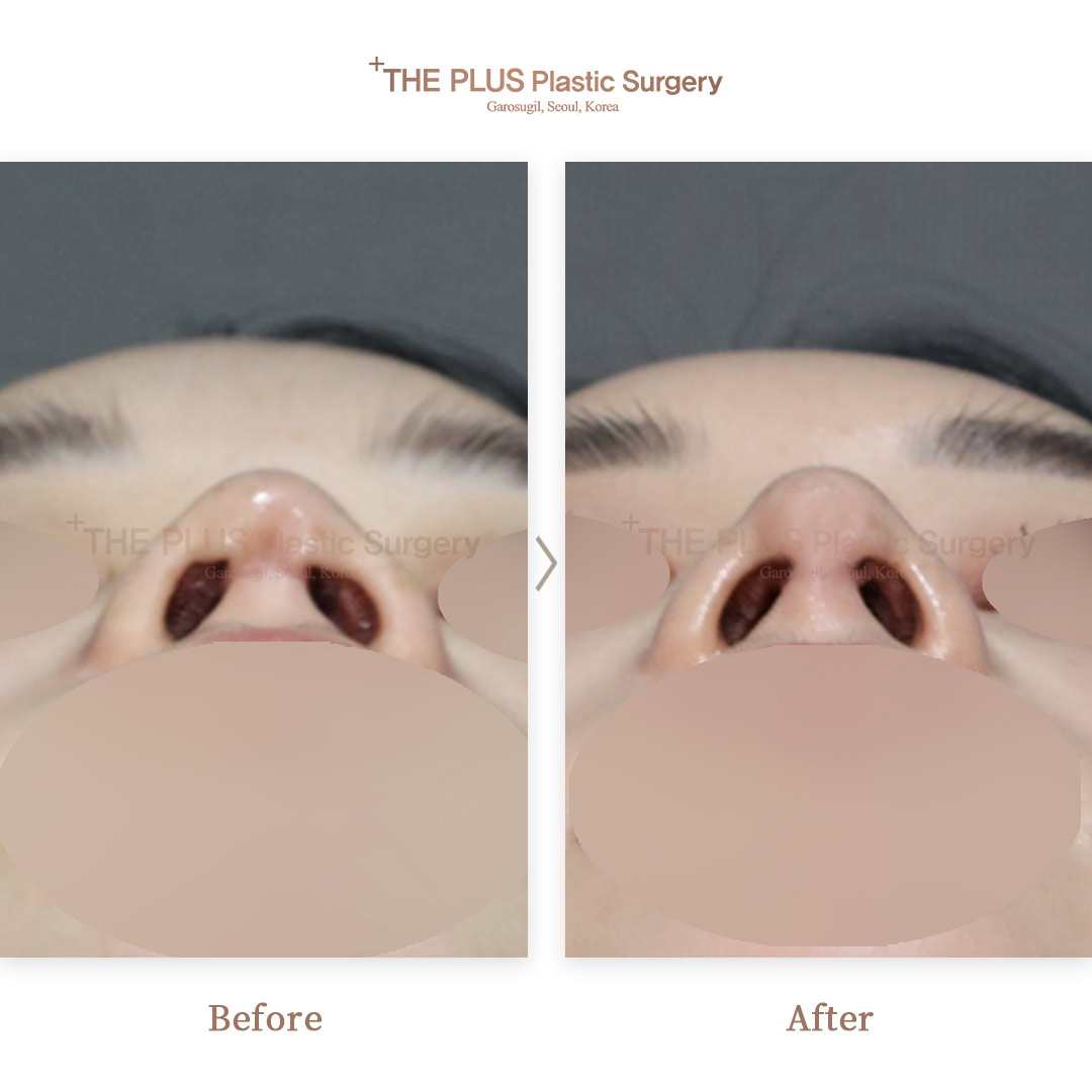THE PLUS CLINIC KOREA -