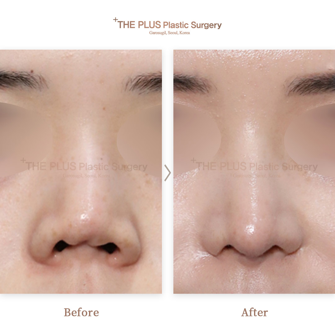 THE PLUS CLINIC KOREA -