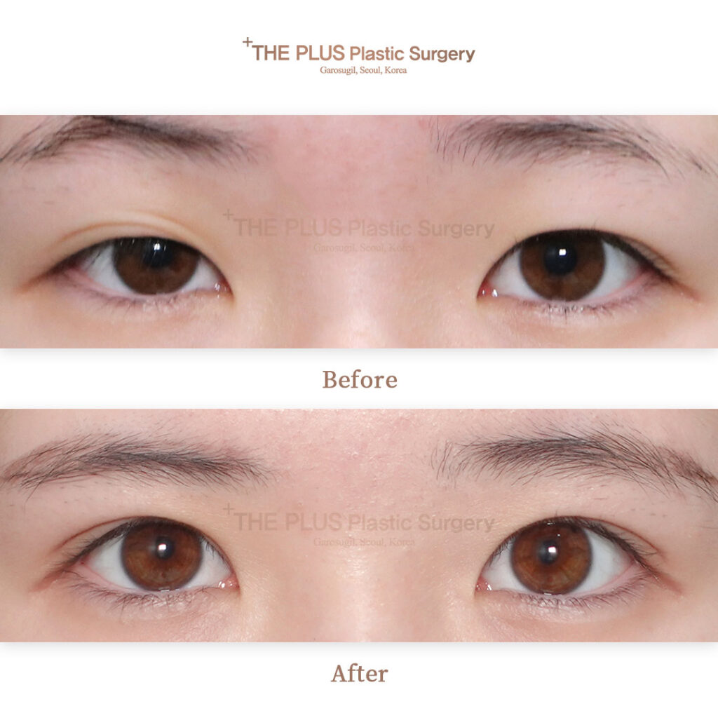 THE PLUS CLINIC KOREA -