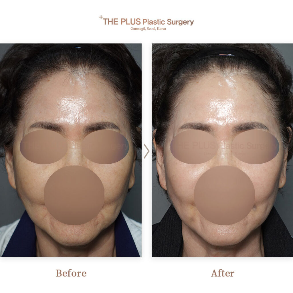 THE PLUS CLINIC KOREA -