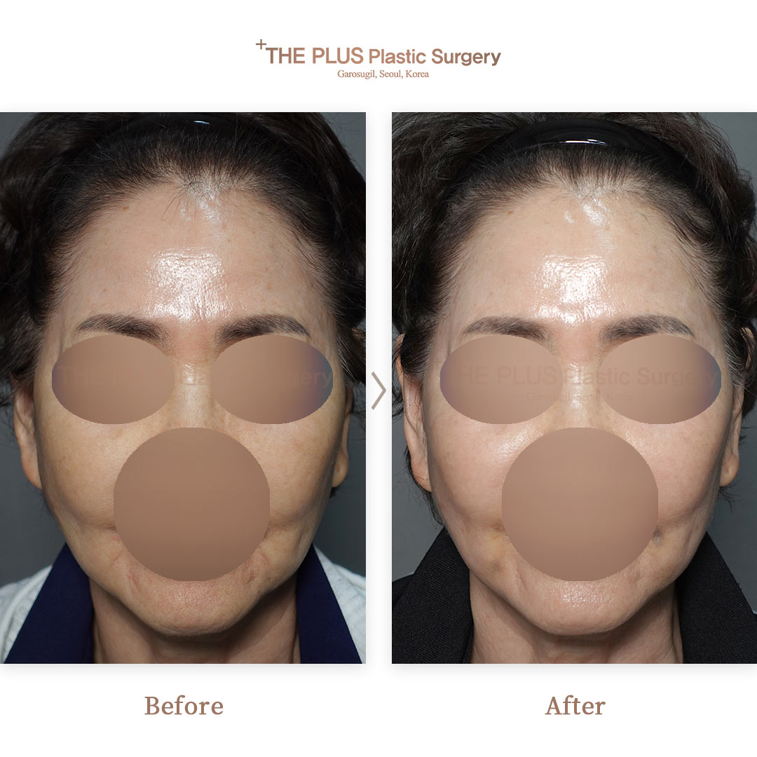 THE PLUS CLINIC KOREA -