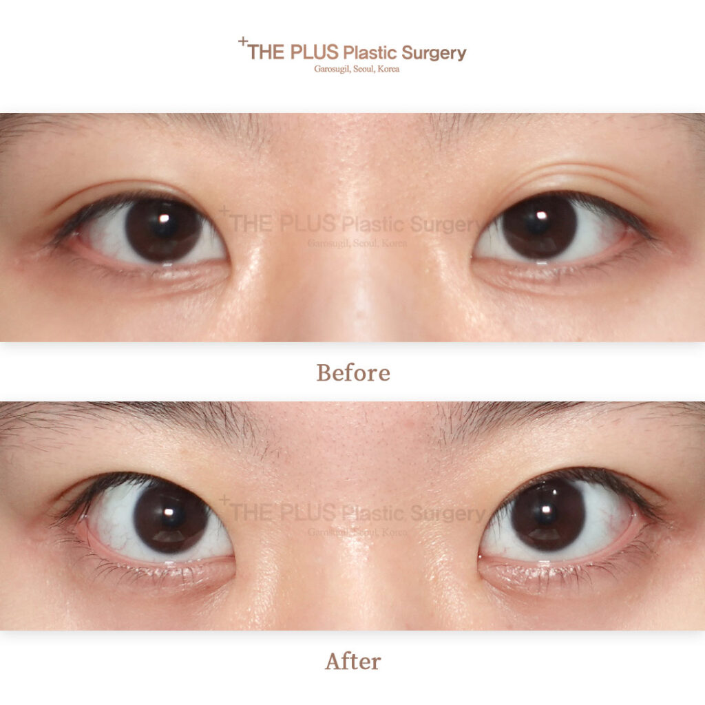 THE PLUS CLINIC KOREA -
