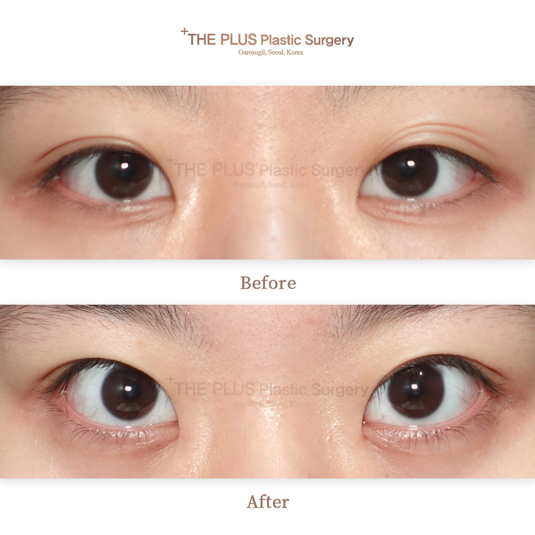 THE PLUS CLINIC KOREA -