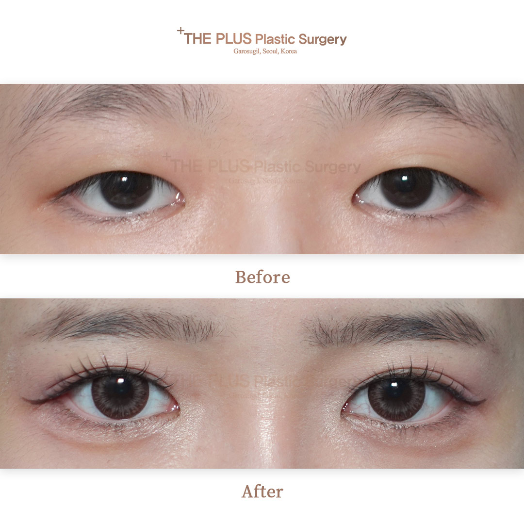 THE PLUS CLINIC KOREA -