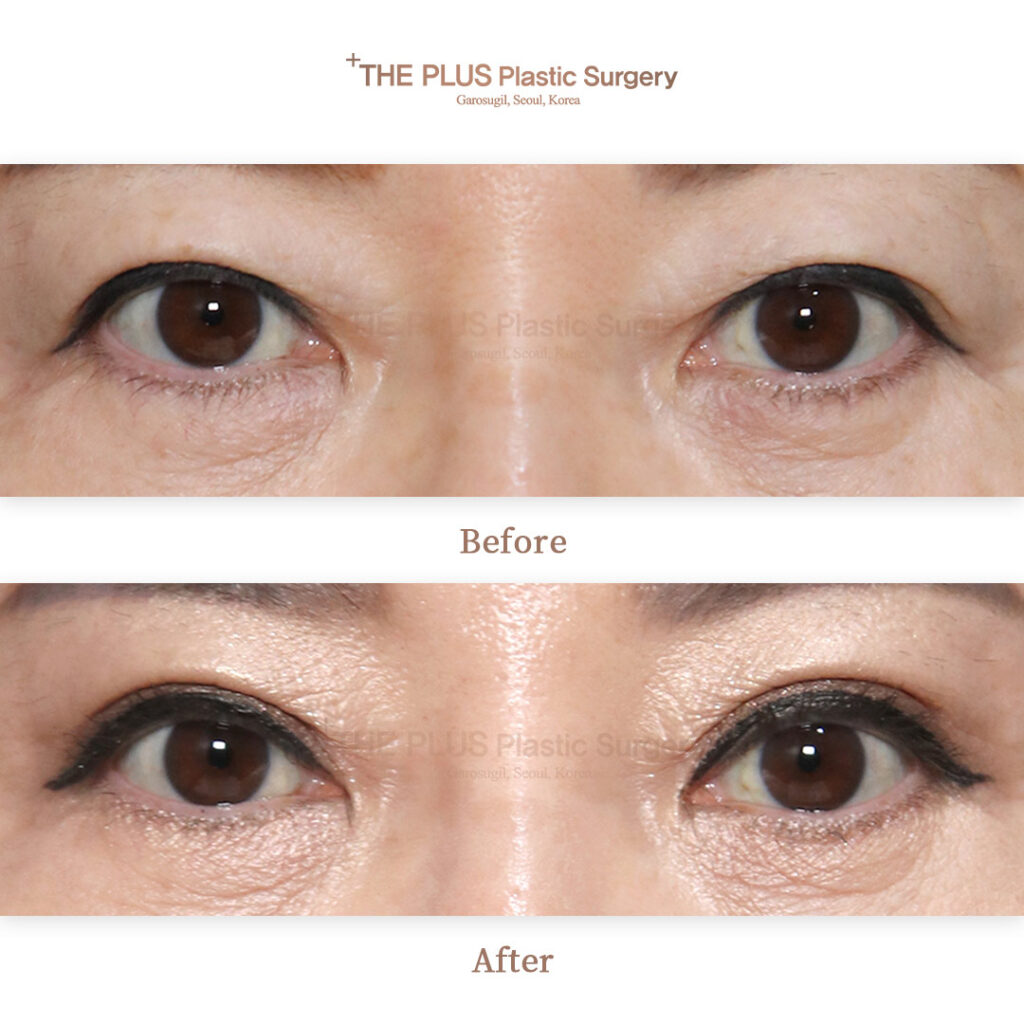 THE PLUS CLINIC KOREA -