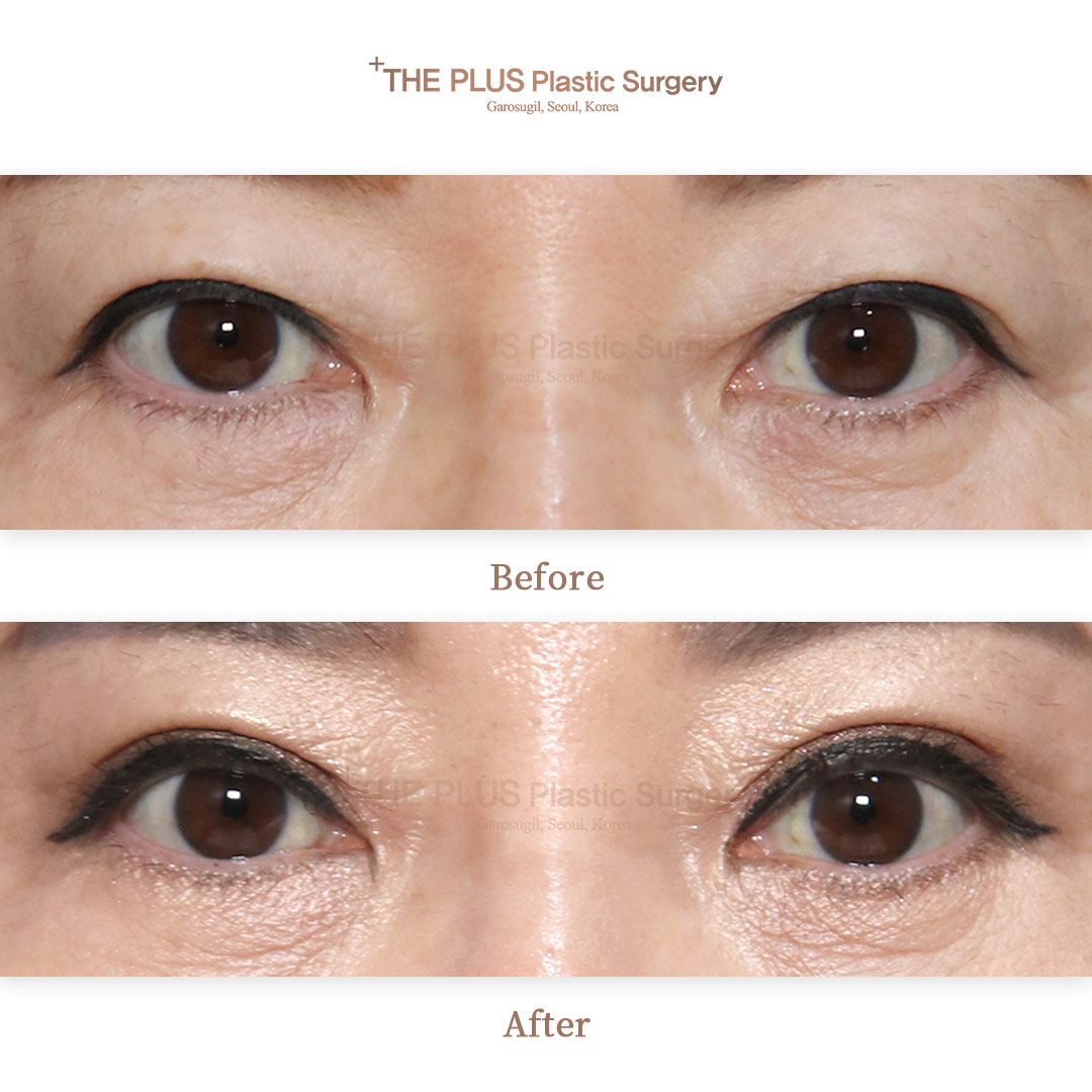 THE PLUS CLINIC KOREA -