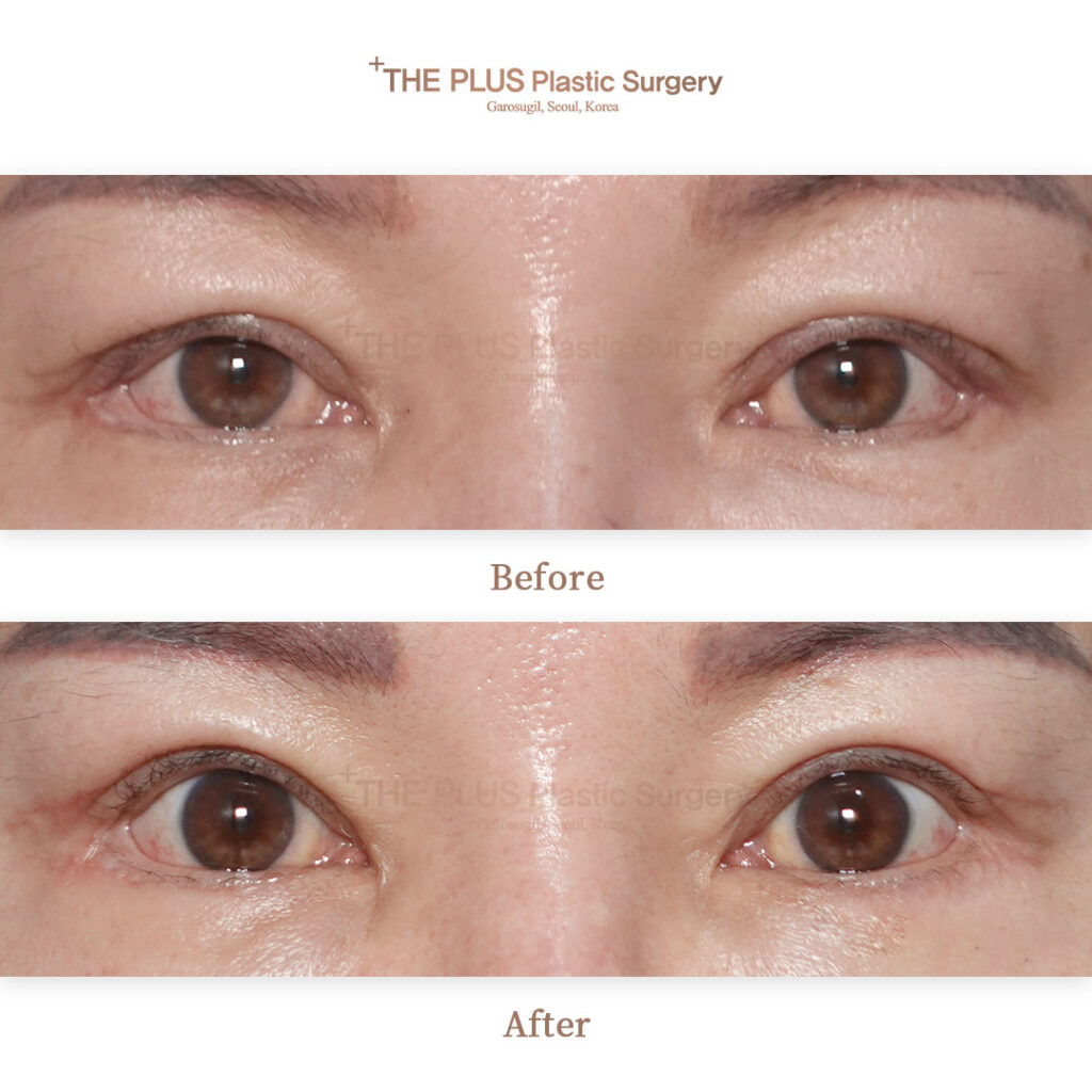 THE PLUS CLINIC KOREA -