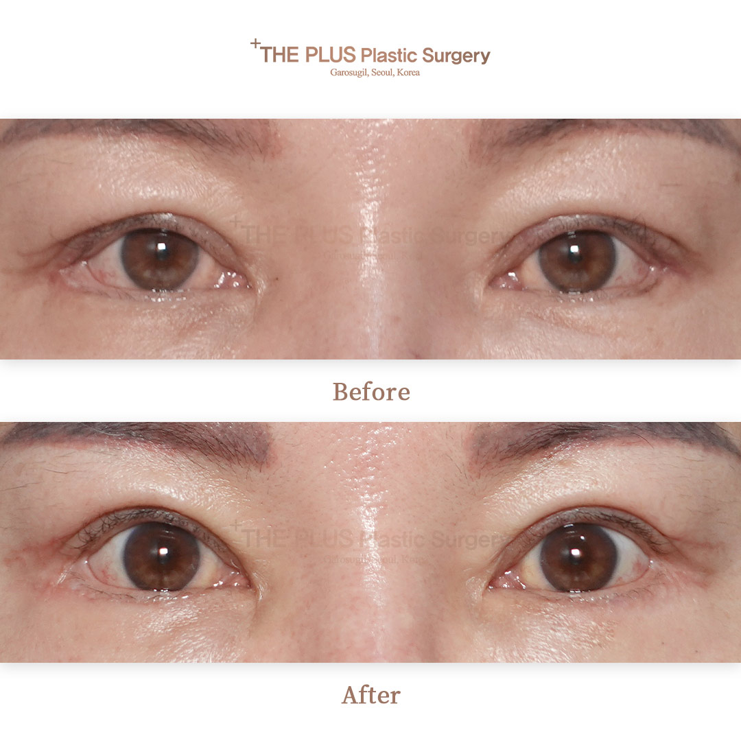 THE PLUS CLINIC KOREA -