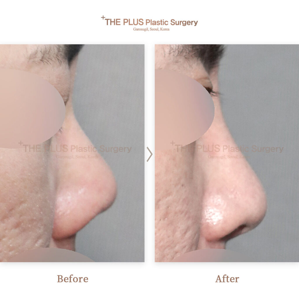 THE PLUS CLINIC KOREA -