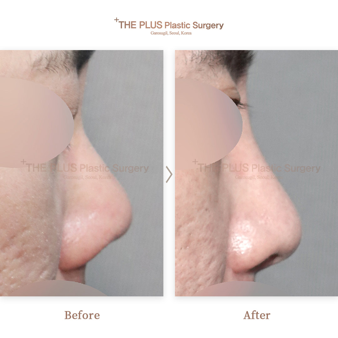 THE PLUS CLINIC KOREA -