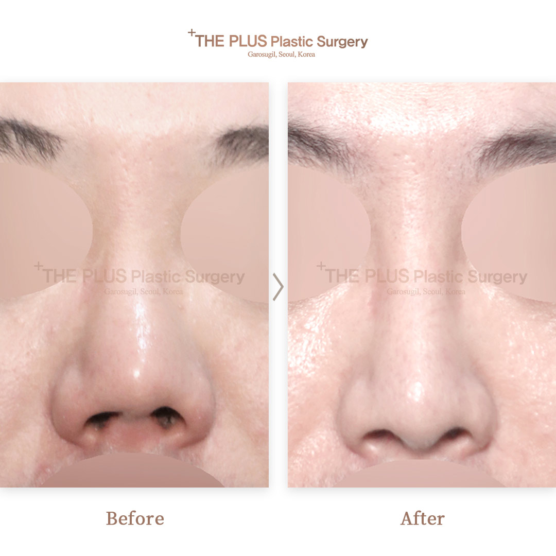 THE PLUS CLINIC KOREA -