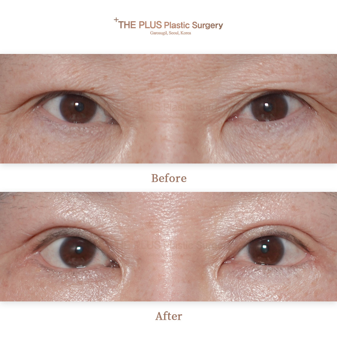 THE PLUS CLINIC KOREA -