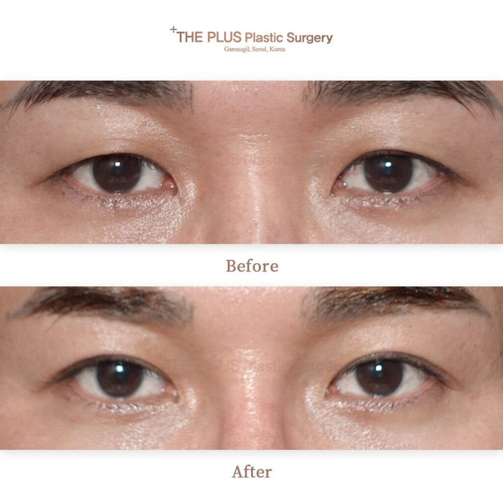 THE PLUS CLINIC KOREA -