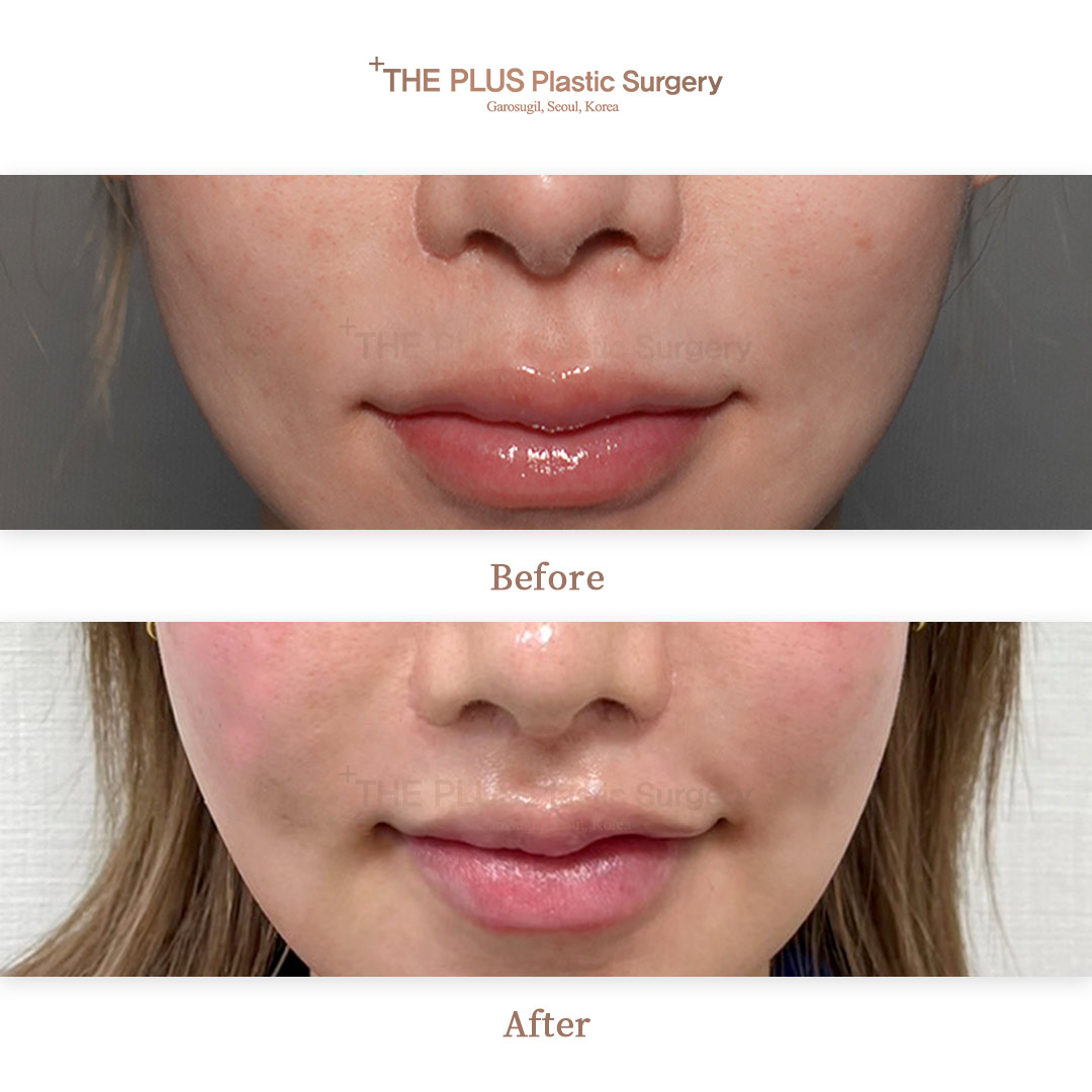 THE PLUS CLINIC KOREA -