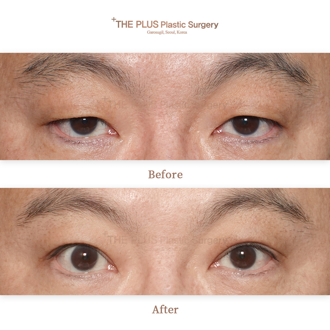THE PLUS CLINIC KOREA -