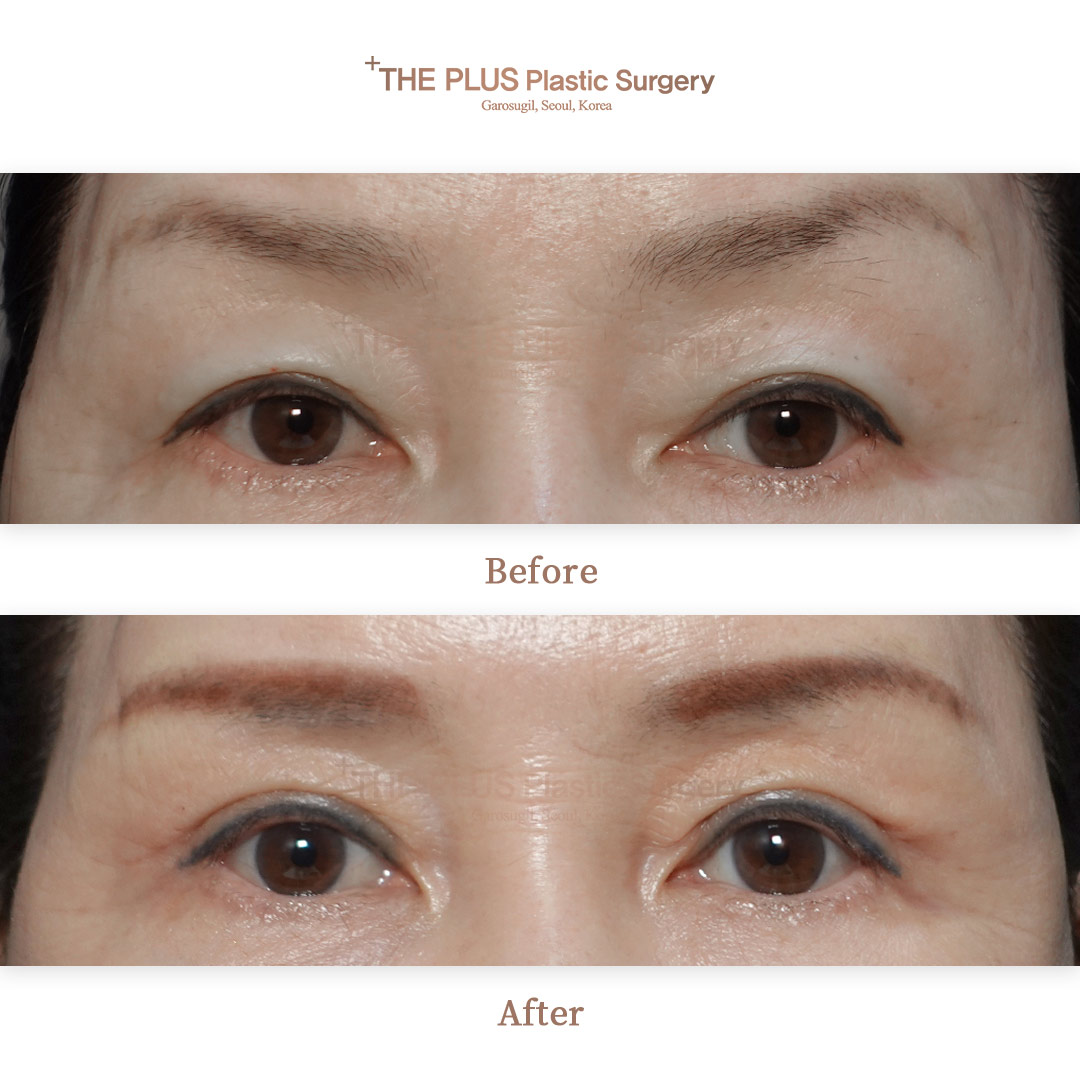 THE PLUS CLINIC KOREA -