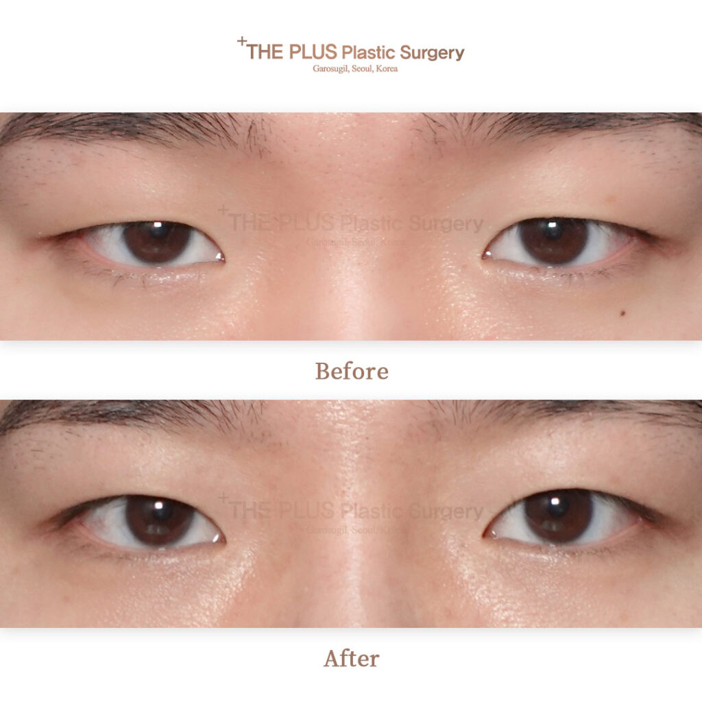 THE PLUS CLINIC KOREA -