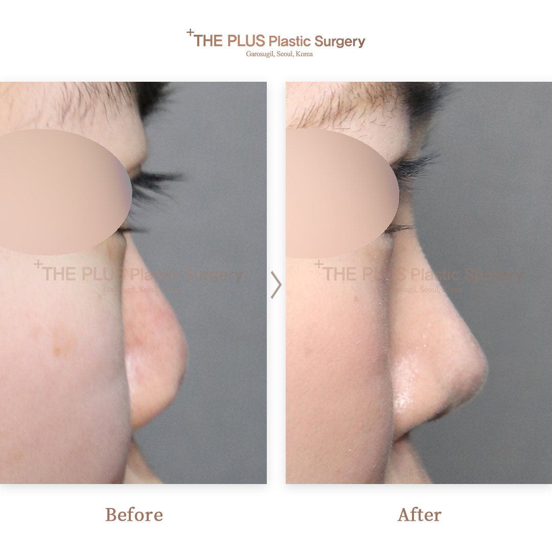 THE PLUS CLINIC KOREA -