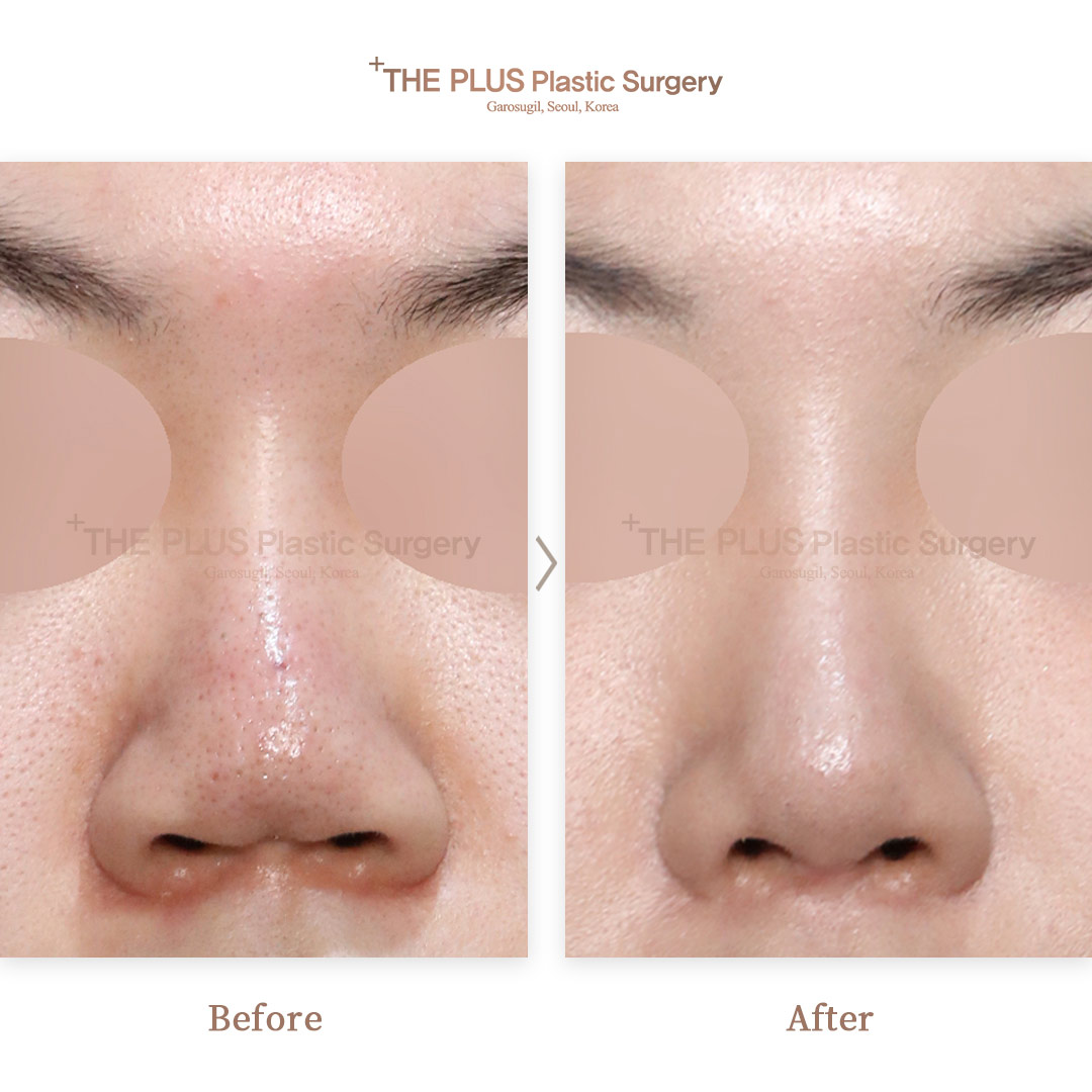 THE PLUS CLINIC KOREA -