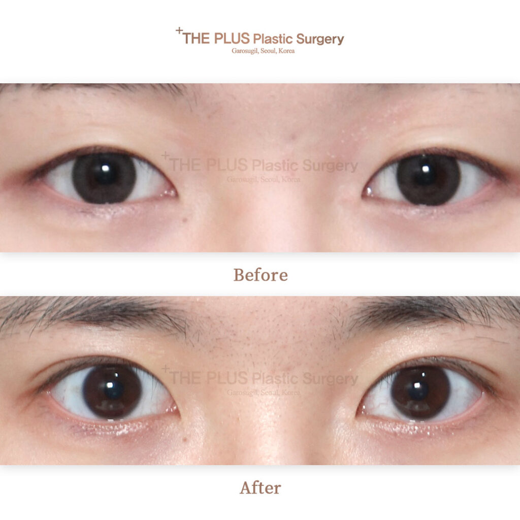 THE PLUS CLINIC KOREA -