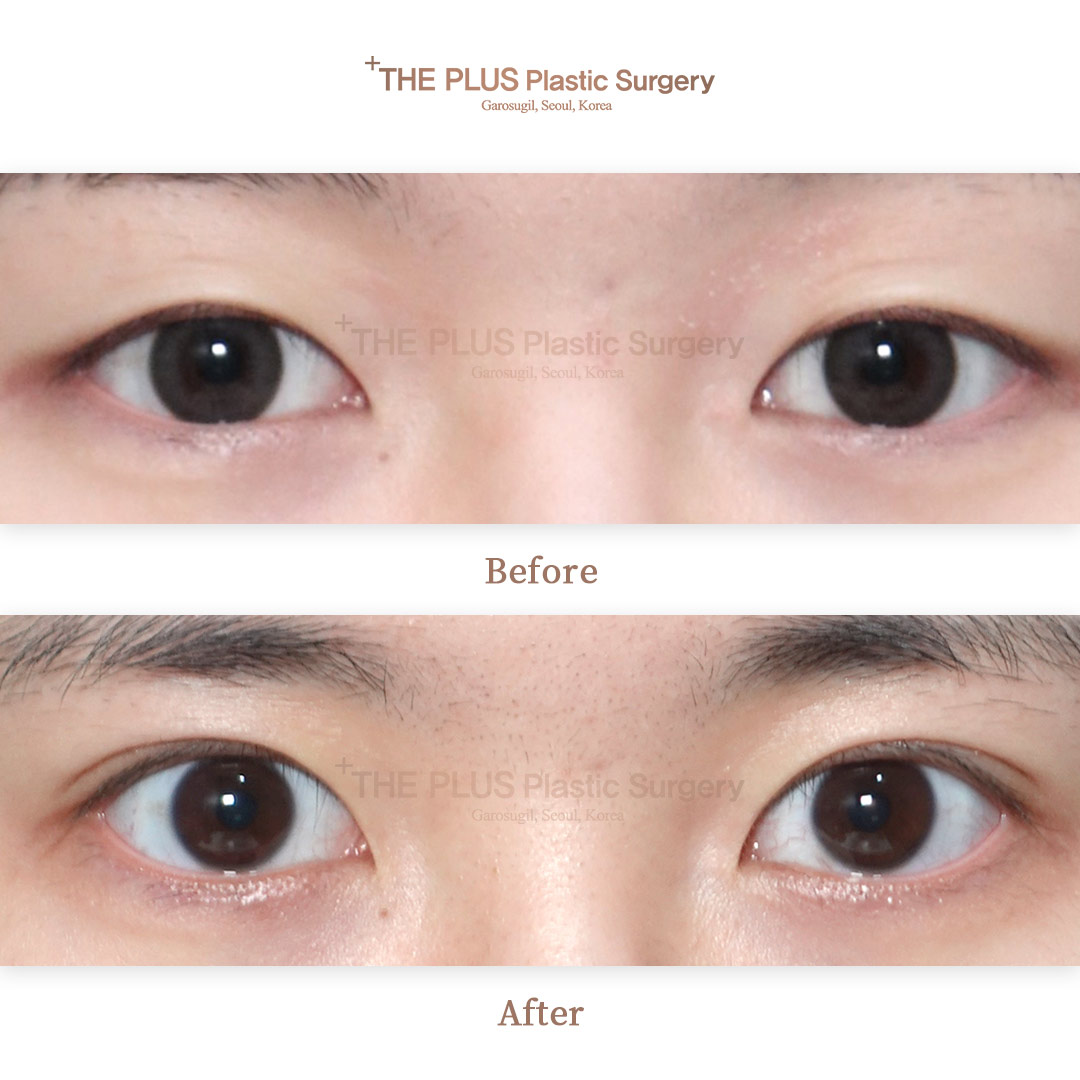 THE PLUS CLINIC KOREA -
