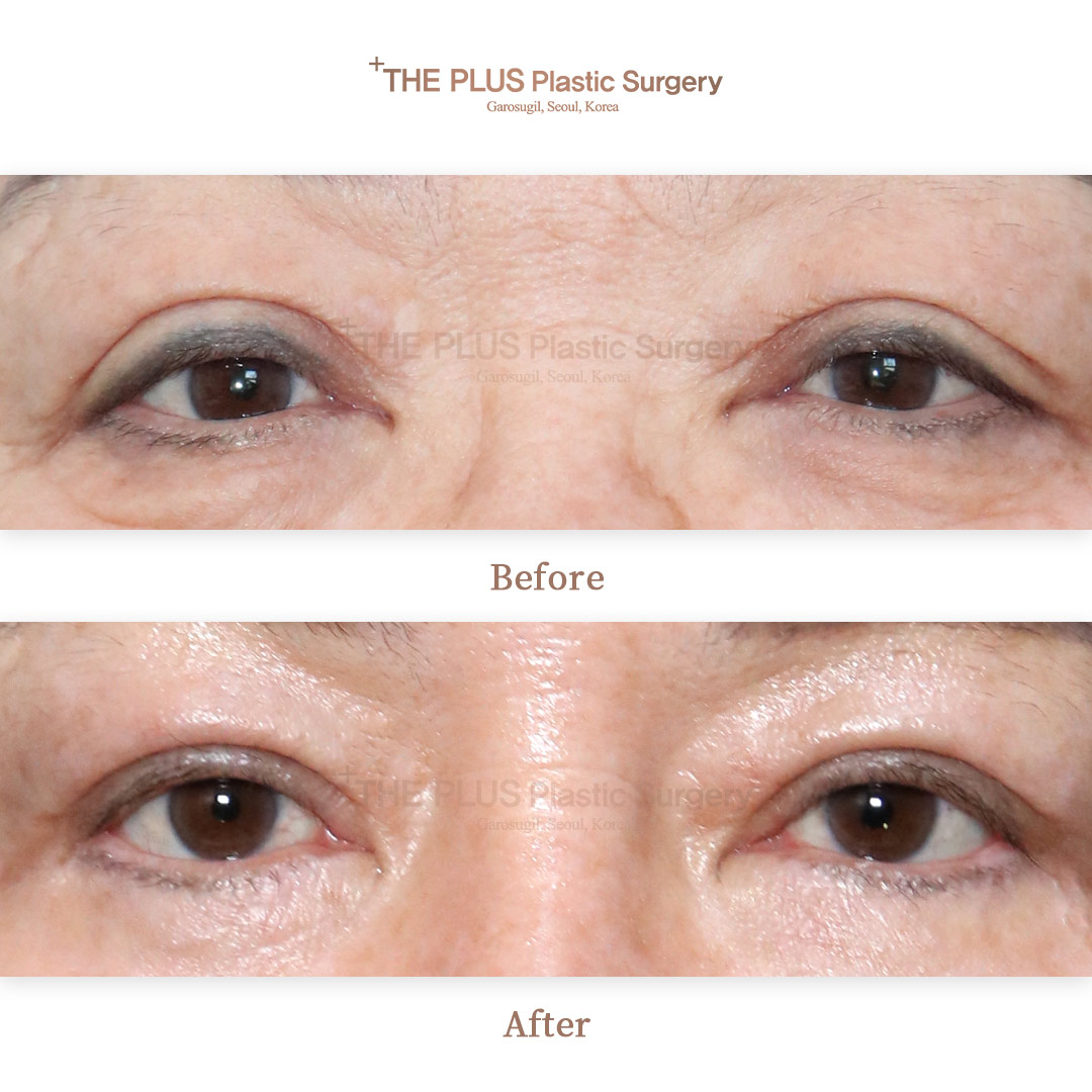THE PLUS CLINIC KOREA -