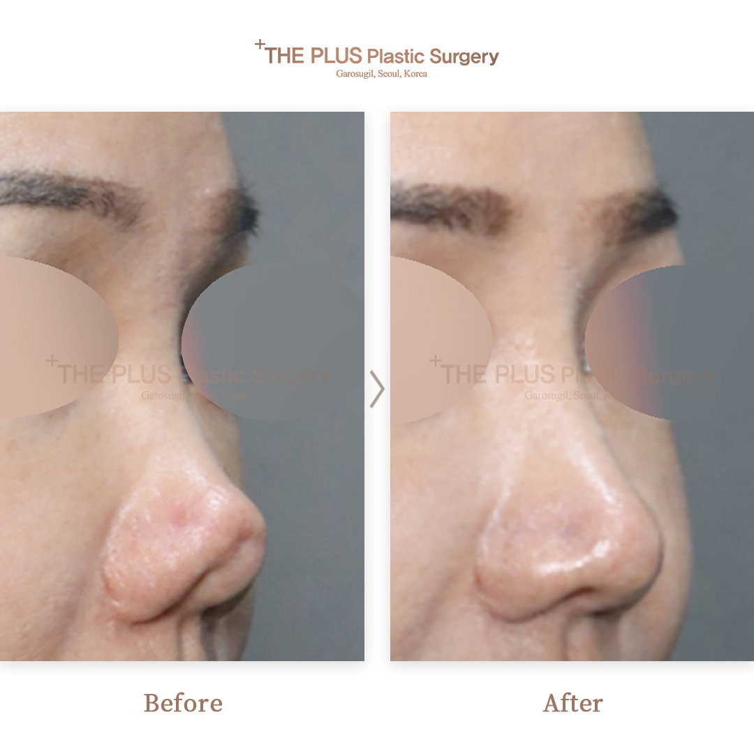 THE PLUS CLINIC KOREA -