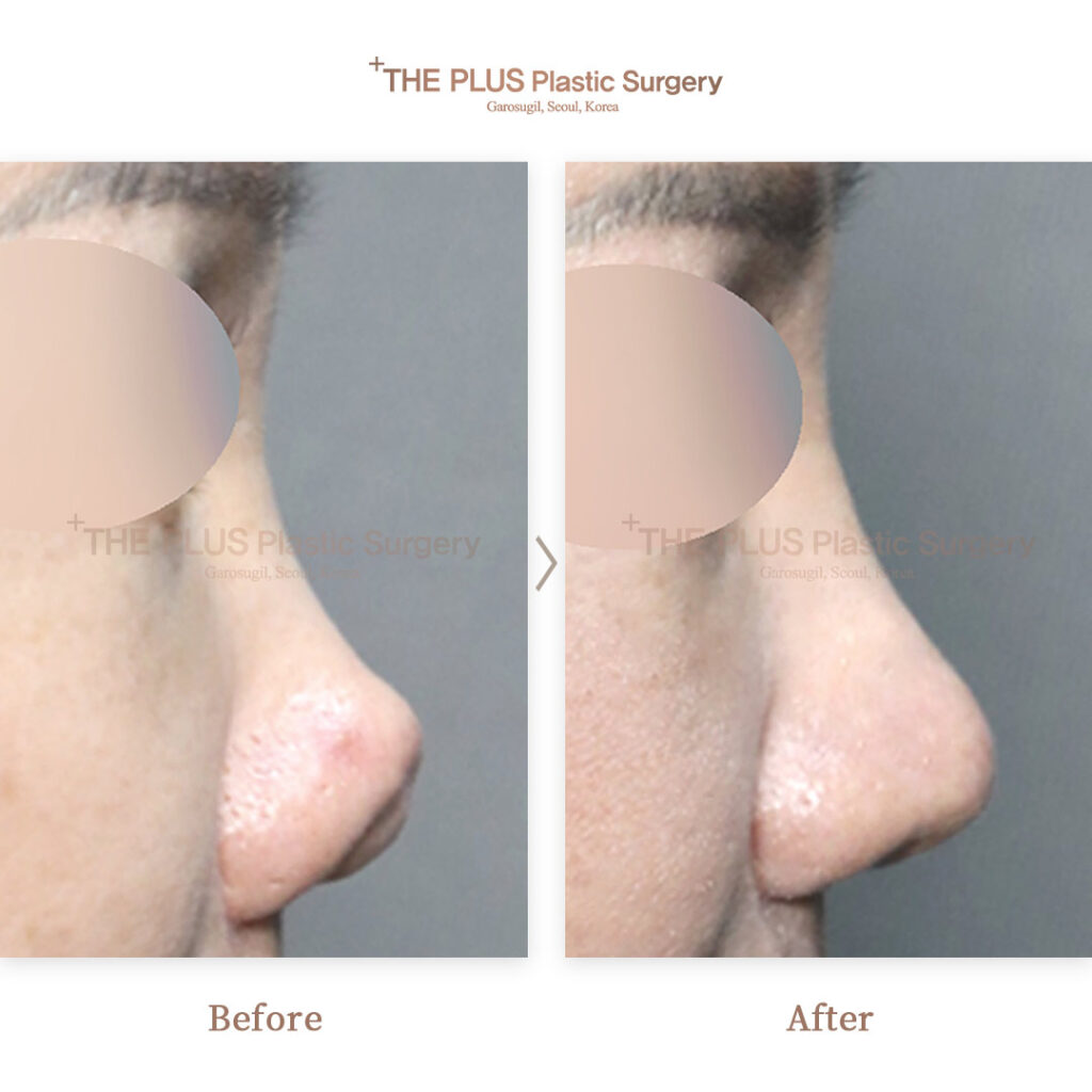 THE PLUS CLINIC KOREA -
