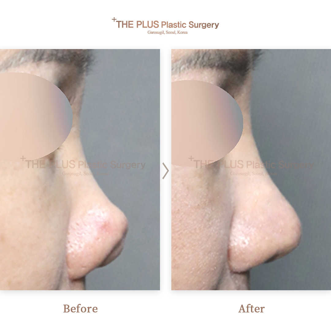 THE PLUS CLINIC KOREA -