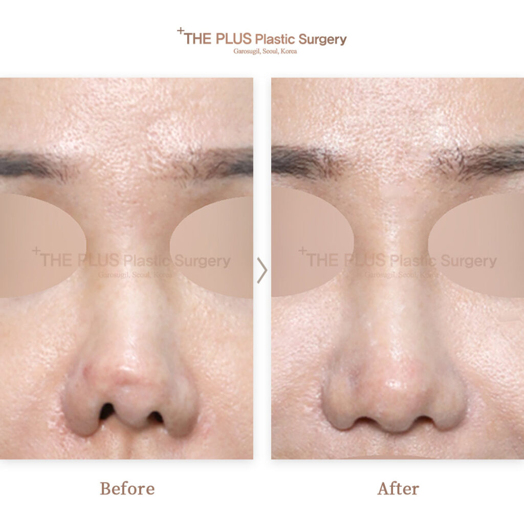 THE PLUS CLINIC KOREA -