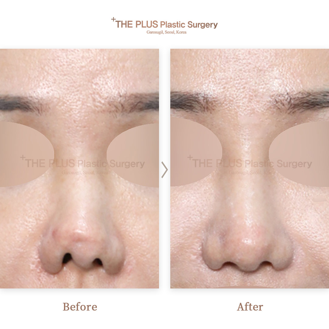 THE PLUS CLINIC KOREA -