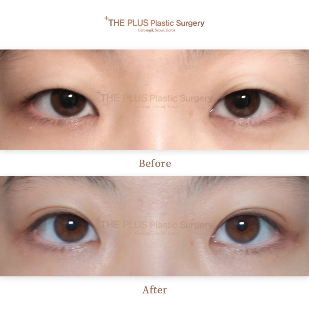 THE PLUS CLINIC KOREA -