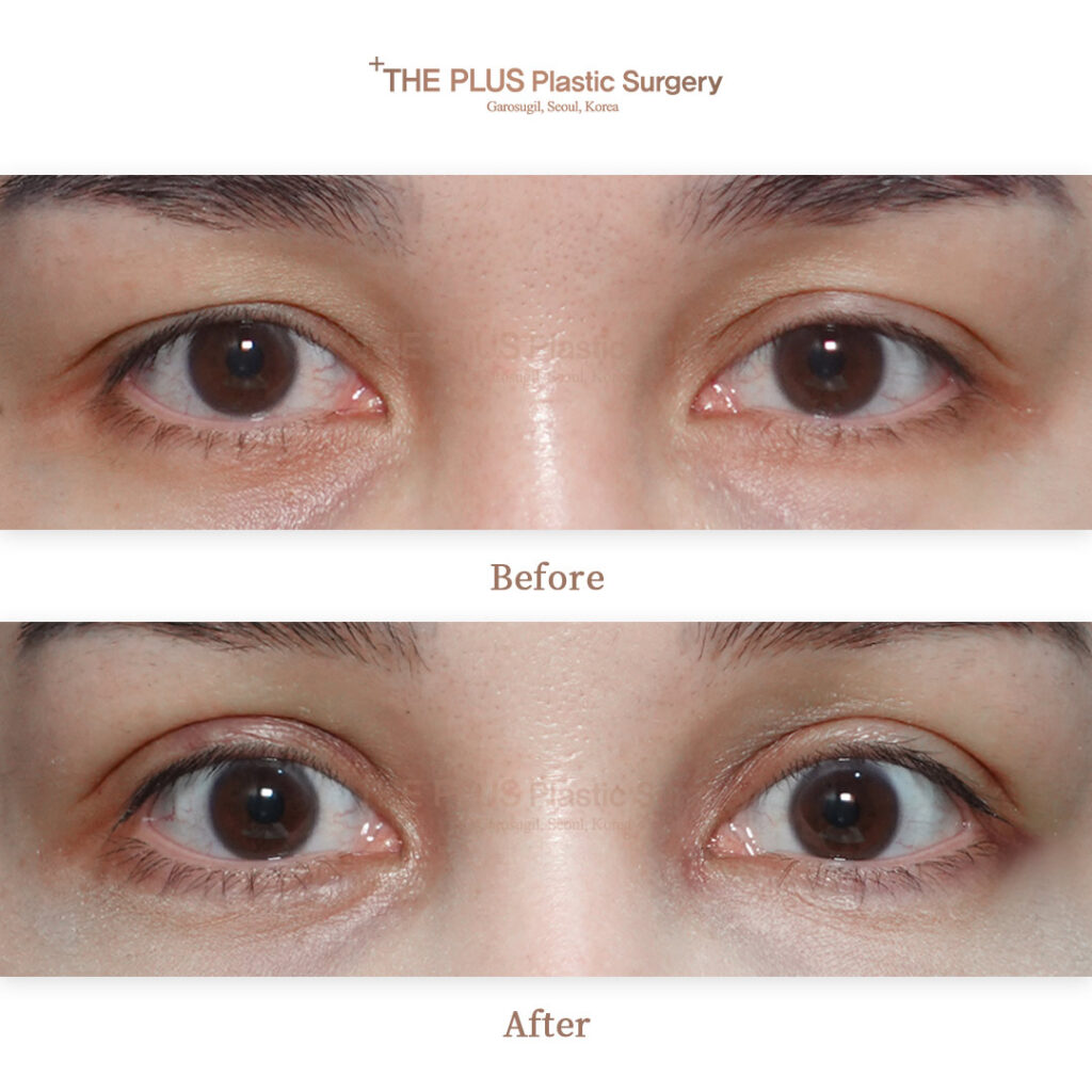 THE PLUS CLINIC KOREA -