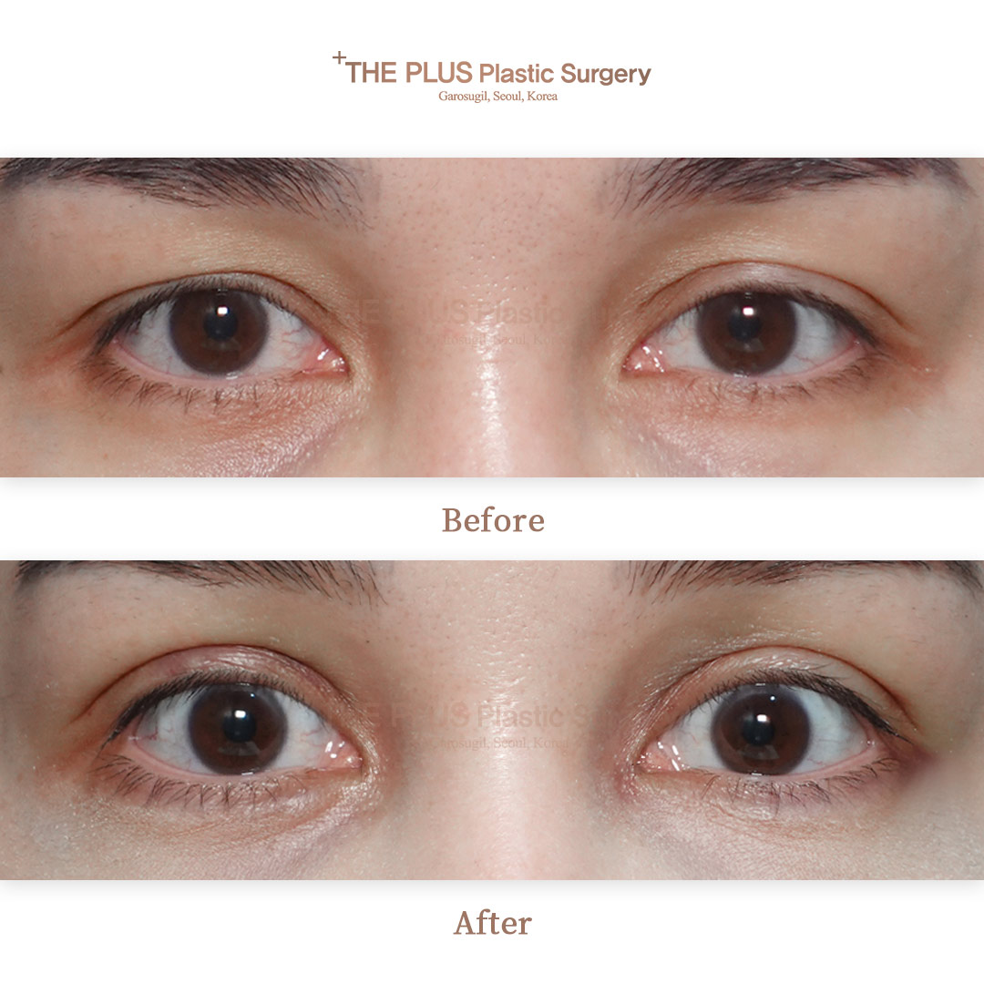 THE PLUS CLINIC KOREA -