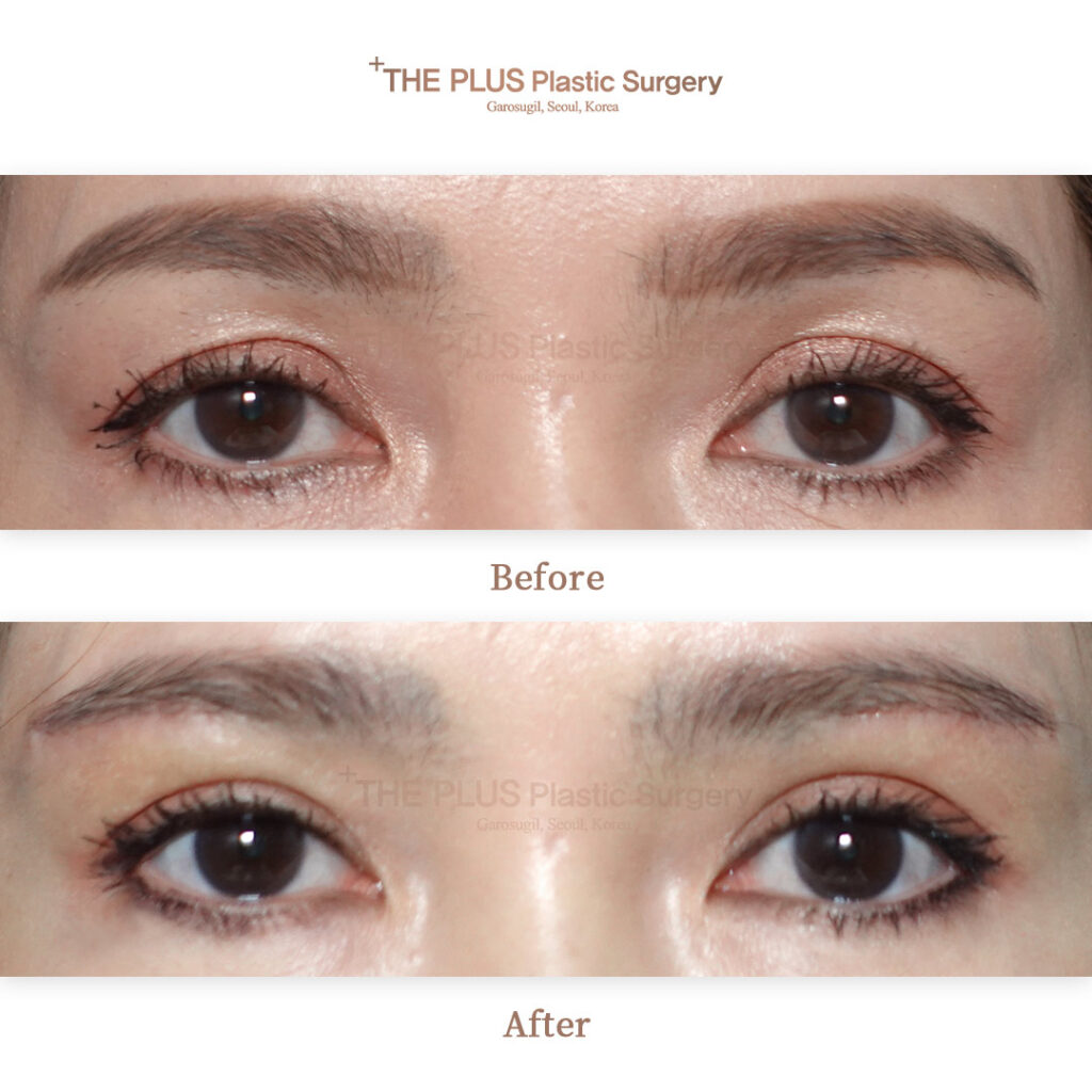 THE PLUS CLINIC KOREA -
