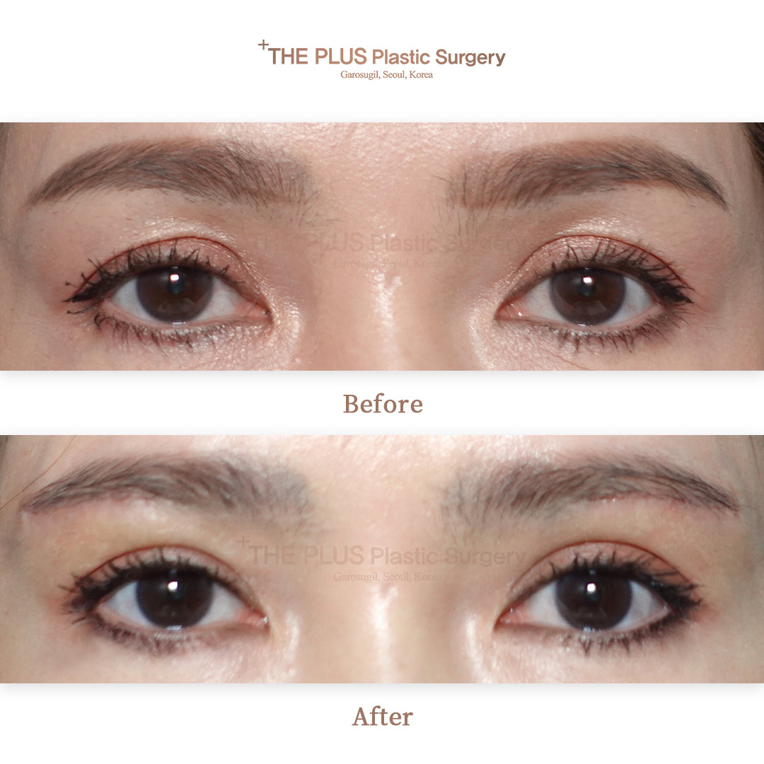THE PLUS CLINIC KOREA -