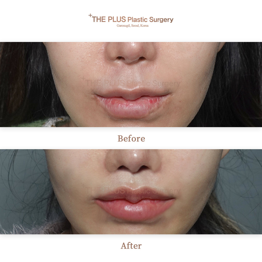 THE PLUS CLINIC KOREA -