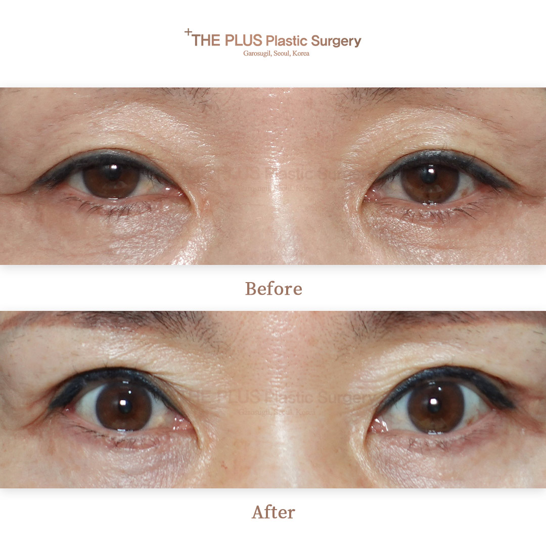 THE PLUS CLINIC KOREA -