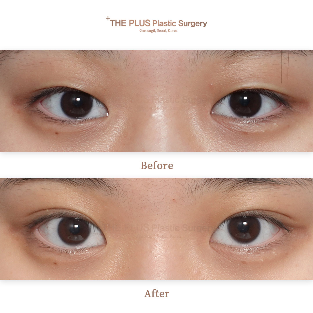 THE PLUS CLINIC KOREA -