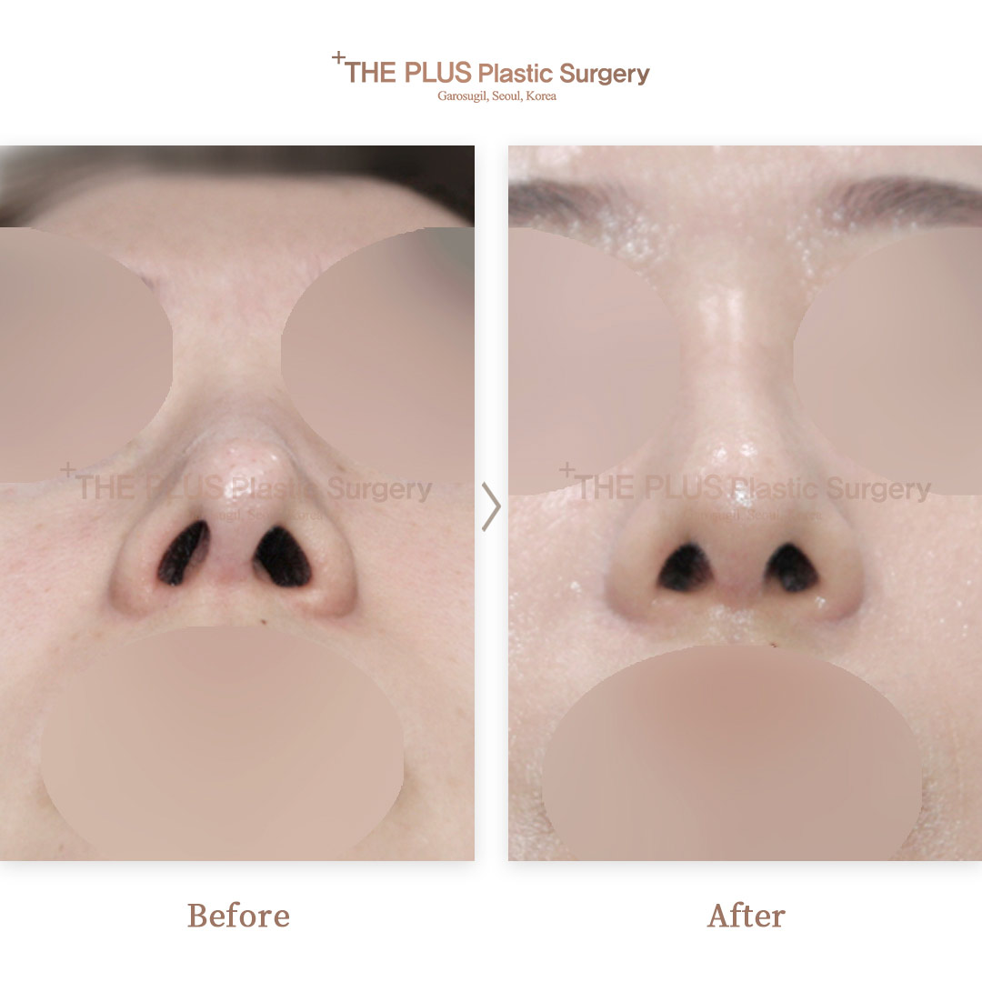THE PLUS CLINIC KOREA -