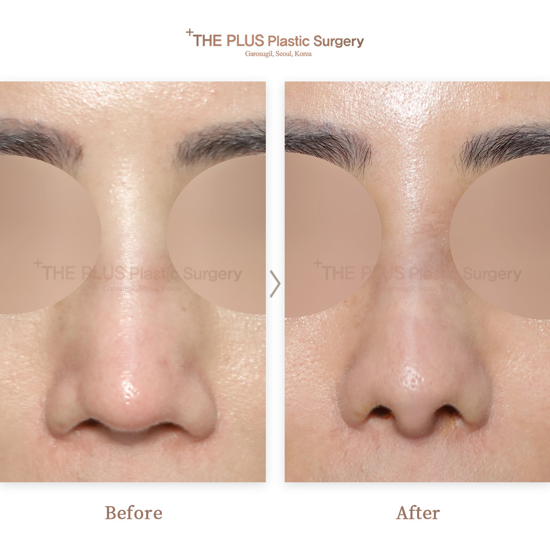 THE PLUS CLINIC KOREA -