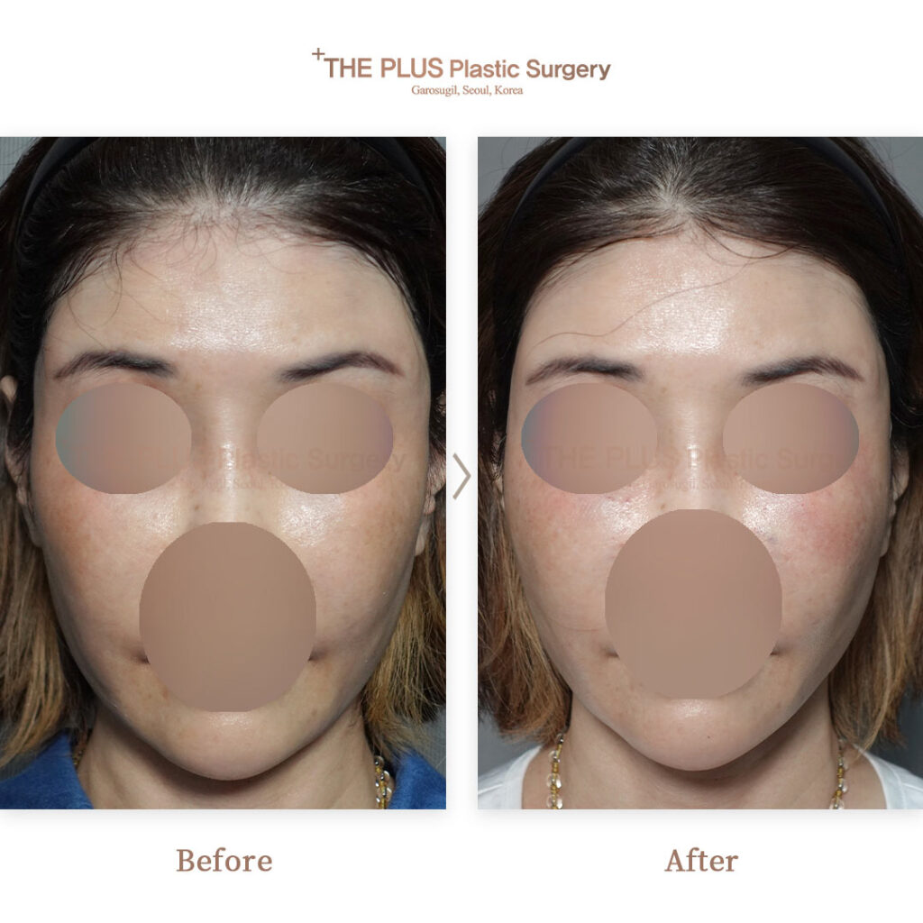 THE PLUS CLINIC KOREA -