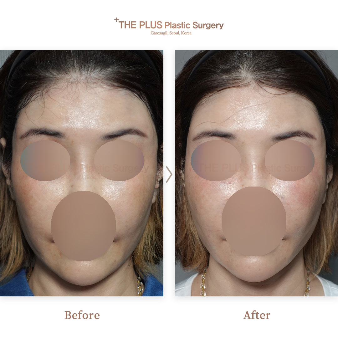 THE PLUS CLINIC KOREA -