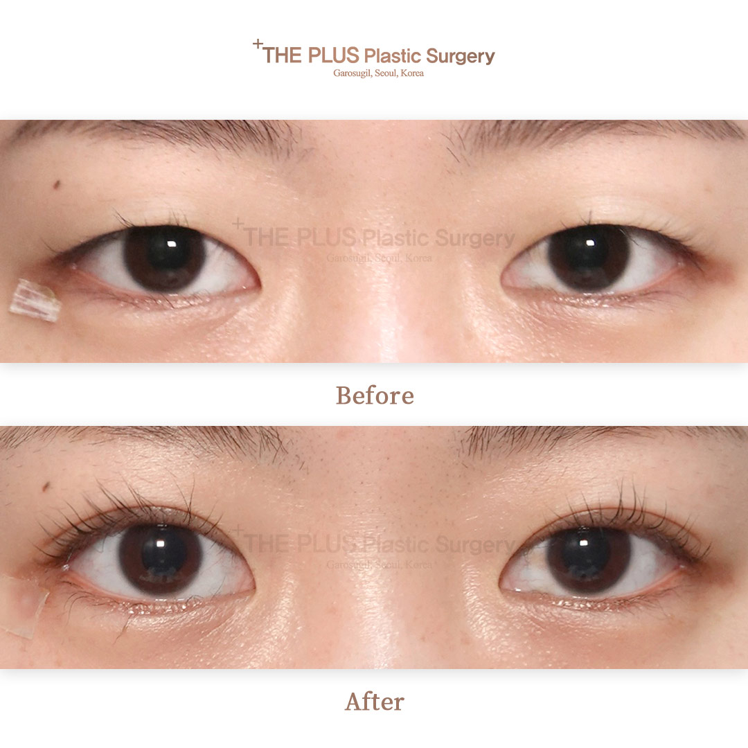 THE PLUS CLINIC KOREA -