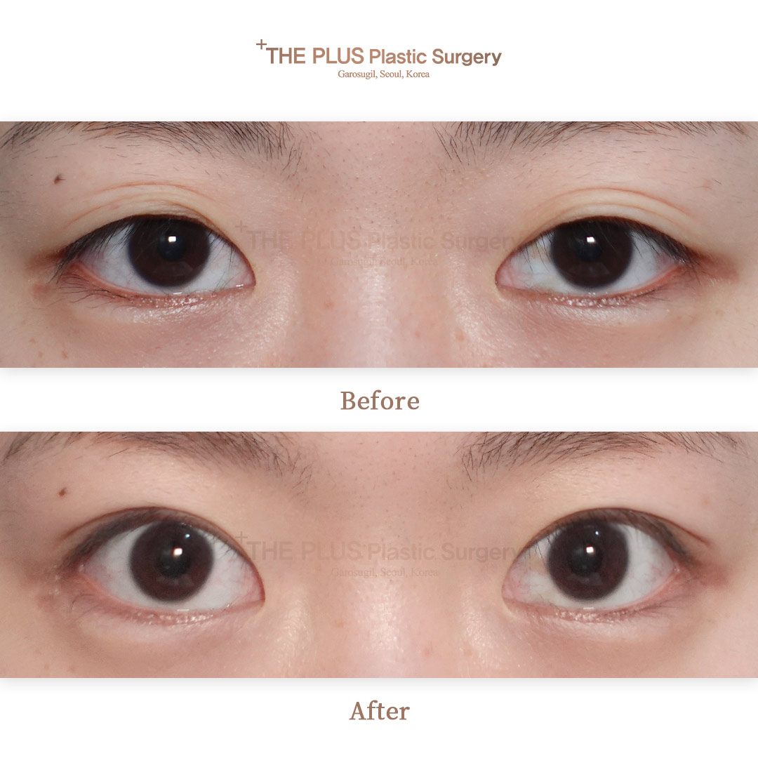 THE PLUS CLINIC KOREA -