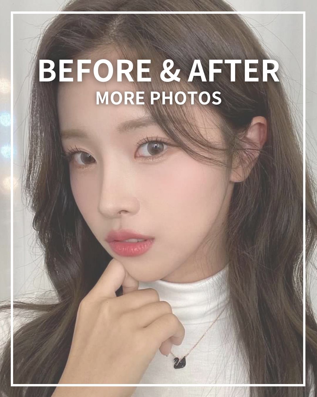 the plus plastic surgery gangnam south korea