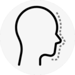 rhinoplasty in Korea the plus plastic surgery gangnam seoul