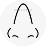 rhinoplasty in korea the plus plastic surgery gangnam